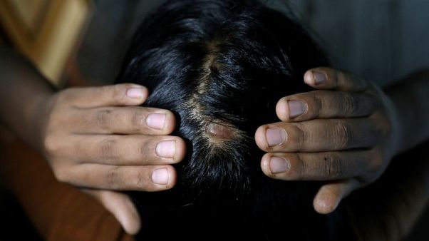 'Until her bones are broken': Myanmar activists fight to outlaw domestic violence 'Until her bones are broken': Myanmar activists fight to outlaw domestic violence
