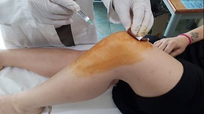 Farmaci reumatologici sono introvabili Farmaci reumatologici sono introvabili