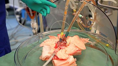 New transplant research aims to salvage infected donated organs New transplant research aims to salvage infected donated organs