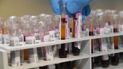 Mosca a Wada, dati doping sono corretti Mosca a Wada, dati doping sono corretti