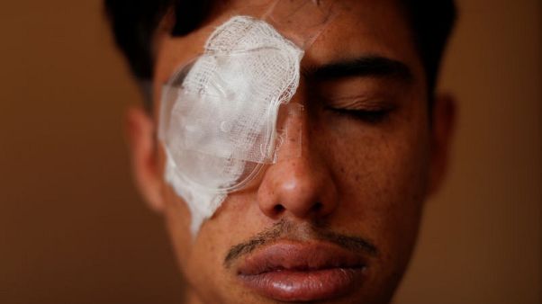 Human rights abuse accusations proliferate in Chile unrest Human rights abuse accusations proliferate in Chile unrest