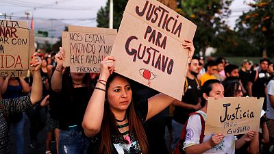 Blinded by rubber bullets, Chilean student becomes rallying point for protesters Blinded by rubber bullets, Chilean student becomes rallying point for protesters