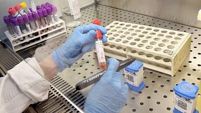 Coronavirus: donna positiva a Catania Coronavirus: donna positiva a Catania