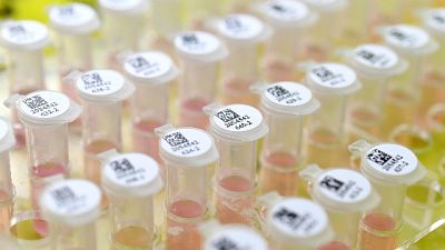 Coronavirus, seconda vittima Marche Coronavirus, seconda vittima Marche