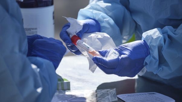 87 nuovi casi in Sardegna, totali 293 87 nuovi casi in Sardegna, totali 293