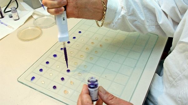 Coronavirus:oggi 88 positivi, totale 837 Coronavirus:oggi 88 positivi, totale 837