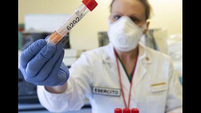 Spallanzani.più dimessi meno ricoveri Spallanzani.più dimessi meno ricoveri