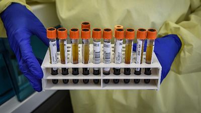 Parafarmacia fa test, denuncia Nas Parafarmacia fa test, denuncia Nas