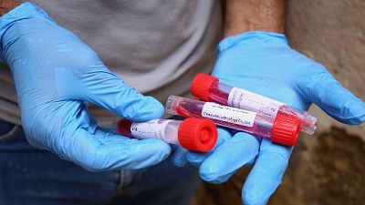Aumento contagi ma meno tamponi in 24h.In 5 regioni 0 nuovi casi Aumento contagi ma meno tamponi in 24h.In 5 regioni 0 nuovi casi