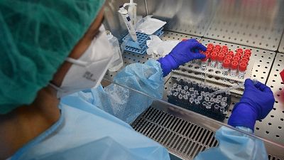 I tamponi effettuati sono stati 7.055, +192 i guariti I tamponi effettuati sono stati 7.055, +192 i guariti