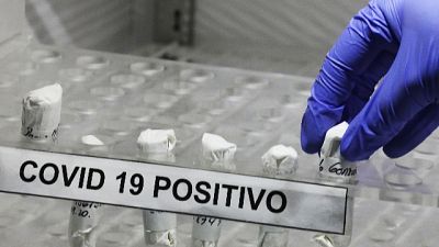 Totale sale a 1.316. Ad oggi eseguiti 129.359 tamponi Totale sale a 1.316. Ad oggi eseguiti 129.359 tamponi