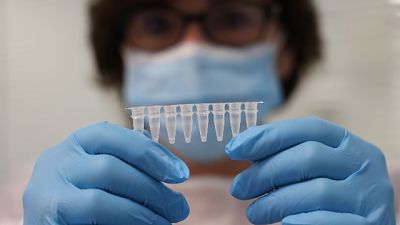 Dopo che 85 test sierologici avevano evidenziato contatto virus Dopo che 85 test sierologici avevano evidenziato contatto virus