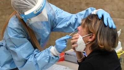 Analizzati 4.377 esami. Ieri 631 nuovi positivi su 5.339 tamponi Analizzati 4.377 esami. Ieri 631 nuovi positivi su 5.339 tamponi