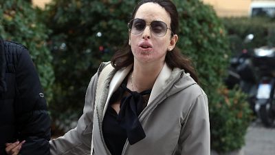 L'udienza il 16 novembre, per stalking e sfregio con l'acido L'udienza il 16 novembre, per stalking e sfregio con l'acido