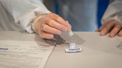 Solo un migliaio i tamponi analizzati Solo un migliaio i tamponi analizzati