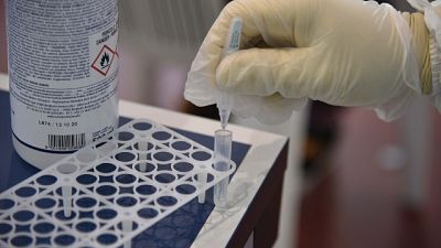 Testati complessivamente 5.796 tamponi. 55 positivi 'antigenici' Testati complessivamente 5.796 tamponi. 55 positivi 'antigenici'