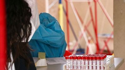 19 mila tamponi in più, stabile numero casi. Veneto sempre primo 19 mila tamponi in più, stabile numero casi. Veneto sempre primo