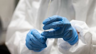 51 da test rapidi. Analizzati complessivamente 4.729 tamponi 51 da test rapidi. Analizzati complessivamente 4.729 tamponi