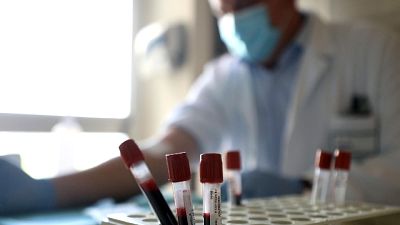 In base a indicazioni medici ci sono plafond. Regia nazionale In base a indicazioni medici ci sono plafond. Regia nazionale