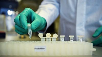 CureVac dice producción masiva de vacunas peligra por restricciones impuestas por EEUU CureVac dice producción masiva de vacunas peligra por restricciones impuestas por EEUU