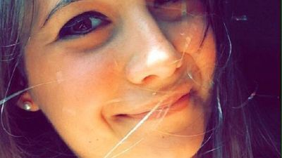Aggredita due giorni fa da un quindicenne, è stata estubata Aggredita due giorni fa da un quindicenne, è stata estubata