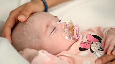 Two-month-old Spanish baby saved by pioneering heart transplant