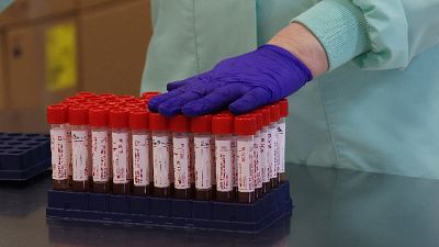 3.101 tamponi, 1.506 nuove diagnosi, positivi/testati 5,5% 3.101 tamponi, 1.506 nuove diagnosi, positivi/testati 5,5%