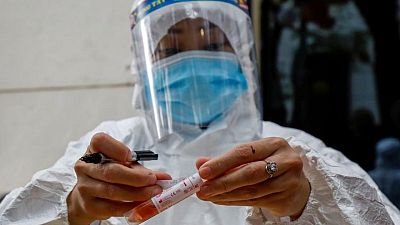 Los casos del virus en todo el mundo superan los 171,99 millones y las muertes alcanzan las 3.725.790 Los casos del virus en todo el mundo superan los 171,99 millones y las muertes alcanzan las 3.725.790