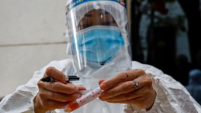 Los casos del virus en todo el mundo superan los 175,86 millones y las muertes alcanzan las 3.955.633 Los casos del virus en todo el mundo superan los 175,86 millones y las muertes alcanzan las 3.955.633