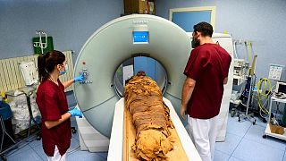 مستشفى إيطالي يستخدم الأشعة المقطعية لكشف أسرار مومياء مصرية
