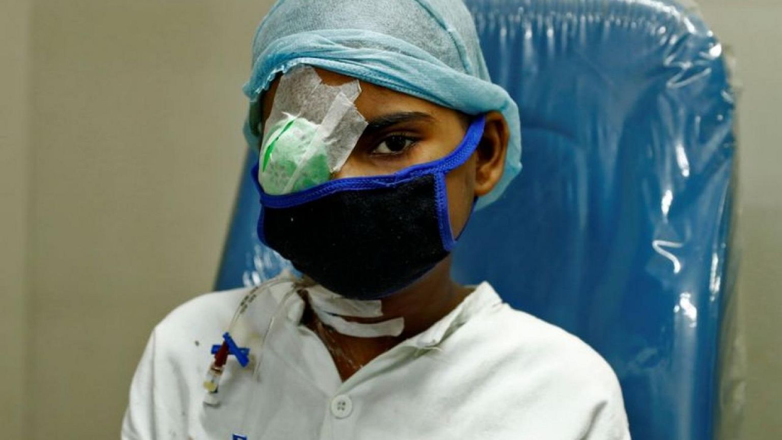 Después del COVID-19, "hongo negro" deja ciegos en India