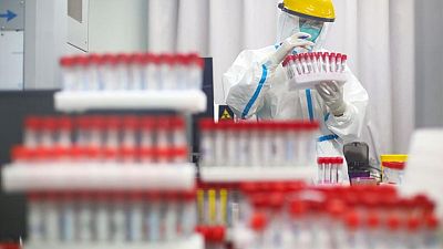 La variante Delta se propaga por Asia con récord de infecciones en Tokio, Tailandia y Malasia La variante Delta se propaga por Asia con récord de infecciones en Tokio, Tailandia y Malasia