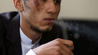 رئيس تحرير: ضرب صحفيَّين أفغانيَّين وهما رهن الاحتجاز لدى طالبان