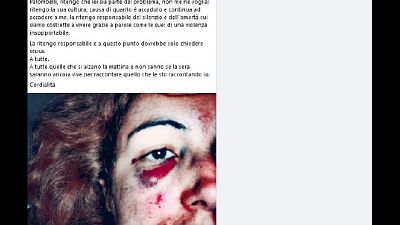 Consigliera Oristano ripubblica sua foto con faccia martoriata