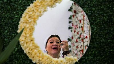 Egyptian group helps burn victims fight stigma Egyptian group helps burn victims fight stigma