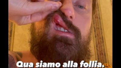 Lottatore irlandese lo mette ko, 'ho scelto di denunciare' Lottatore irlandese lo mette ko, 'ho scelto di denunciare'