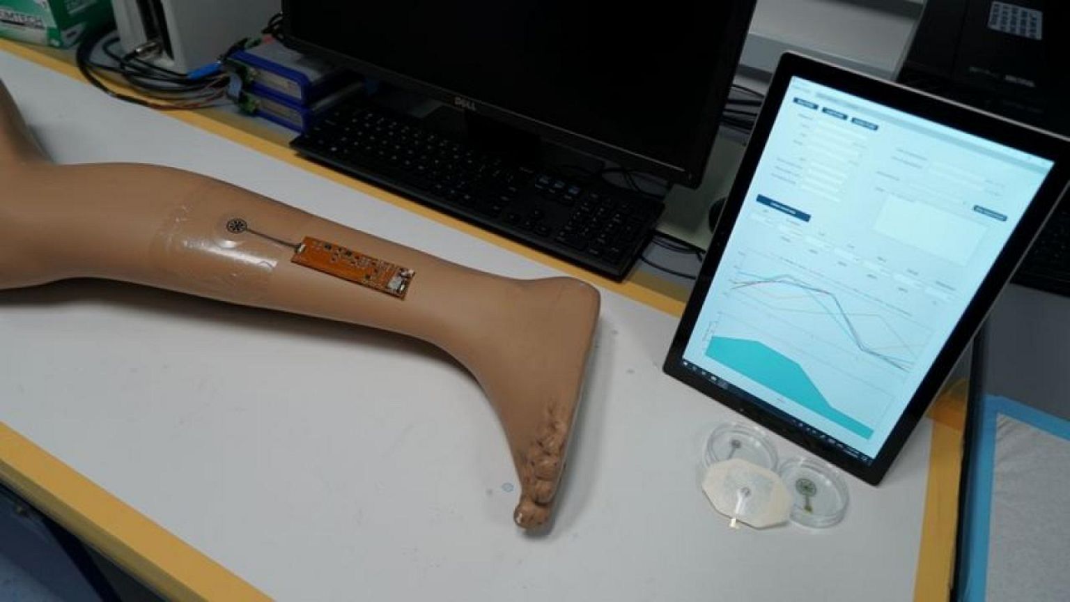 Singapore tests out 'smart bandage' for remote recovery