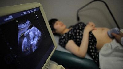 China dará a las mujeres derecho a decidir sobre el parto por cesárea: informe