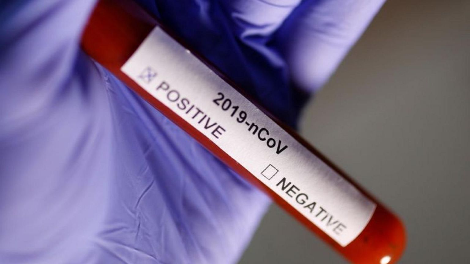 La ivermectina es ineficaz para prevenir los casos graves de COVID-19, según un estudio