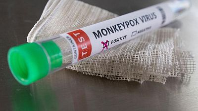 Scotland confirms first case of monkeypox