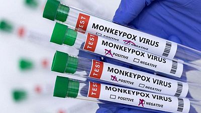 Czech Republic detects its first case of monkeypox Czech Republic detects its first case of monkeypox