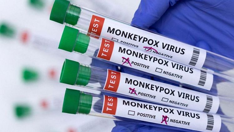 Czech Republic detects its first case of monkeypox