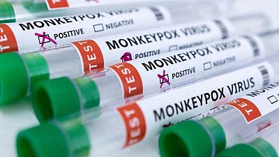 El brote de viruela del mono constituye una emergencia sanitaria mundial: OMS