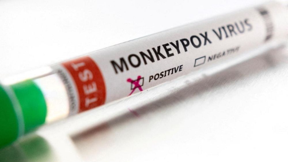 Environ 1 700 personnes en France infectées par le monkeypox, selon le ministre