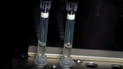 Spain reports second monkeypox-related death in Europe Spain reports second monkeypox-related death in Europe