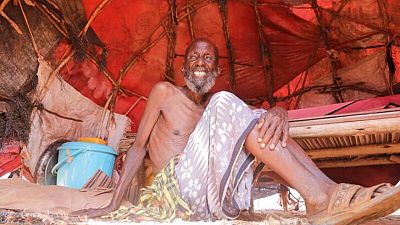 Casi un millón de personas se enfrenta a hambruna en zonas críticas: agencias de la ONU