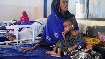سوء تغذية الأطفال يتفاقم في منطقة على شفا المجاعة وسط الصومال