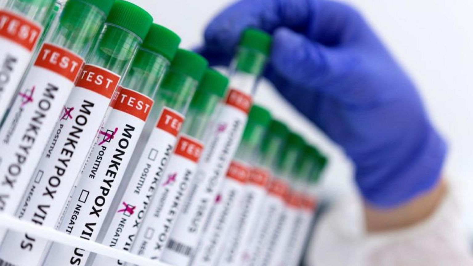 Reino Unido dice que la vacuna contra la viruela símica ofrece una fuerte protección del 78%