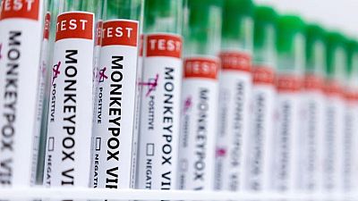 La OMS planea cambiar el nombre de la viruela del mono por el de "MPOX" -Politico La OMS planea cambiar el nombre de la viruela del mono por el de "MPOX" -Politico