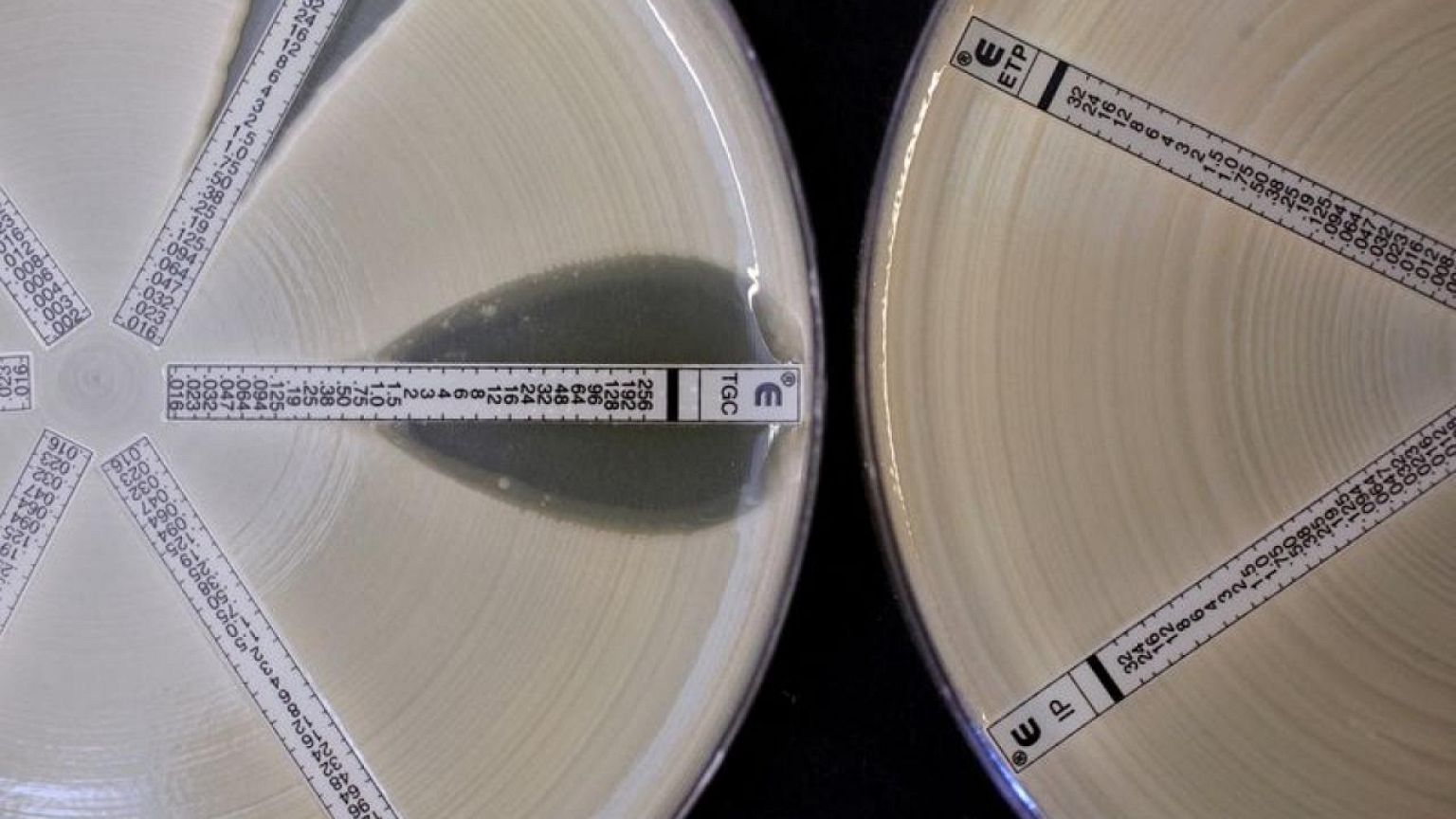 Algunas bacteriemias se hicieron resistentes a los antibióticos de reserva en 2020 -OMS